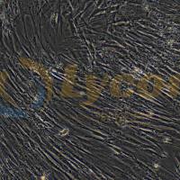 人皮肤成纤维;HFF-1(STR)