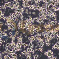 人小细胞肺癌细胞;NCI-H209(STR)