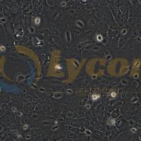 人子宫颈癌细胞；HT-3(STR)