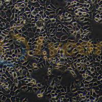 人咽鳞癌细胞;FaDu(STR)