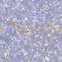 人乳腺癌细胞;MCF-7(STR)