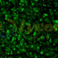 人结肠癌细胞带绿色荧光;HT-29/GFP(STR)
