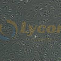 人脐静脉血管内皮细胞；HUVEC(STR)