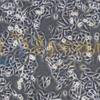 人胃黏膜上皮细胞；GES-1(STR)