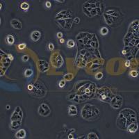 人胃癌细胞；MKN-74(STR)