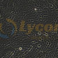 人支气管上皮细胞;BEAS-2B(STR)