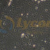 人食道鳞状细胞癌;KYSE410(STR)