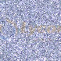 人乳腺导管癌细胞；T47D(STR)