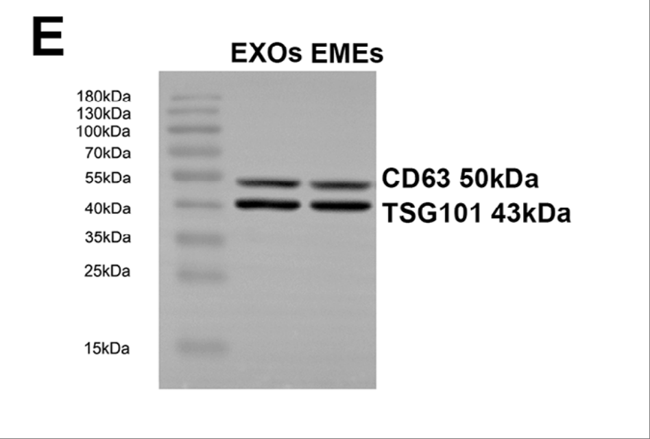IF=10.0 | Umibio特级胎牛血清（UR50100）助力客户椎间盘退变治疗研究！