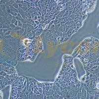 人胰腺癌细胞；HPAF-II(STR)