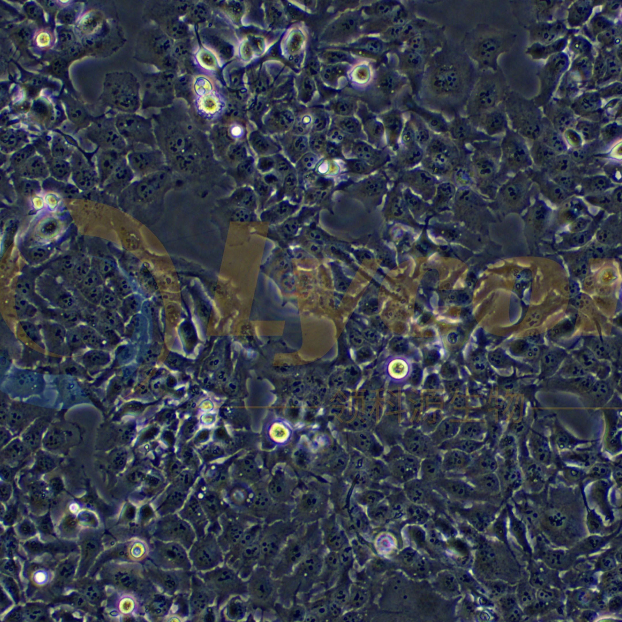 人食管鳞癌细胞;KYSE-150(STR)