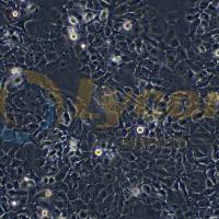 人食管鳞癌细胞；KYSE-150(STR)