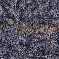 人神经母细胞瘤细胞;SH-SY5Y(STR)