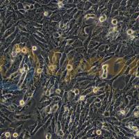 人胃癌细胞(未分化);HGC-27(STR)