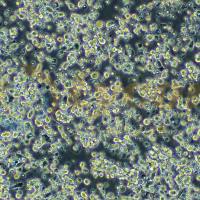 人脑髓母细胞瘤细胞;D283 Med(STR)