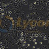 人前列腺癌细胞;DU 145(STR)