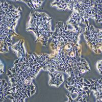 人乳腺导管癌细胞;BT474(STR)