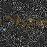 人神经母细胞瘤细胞;SK-N-SH(STR)