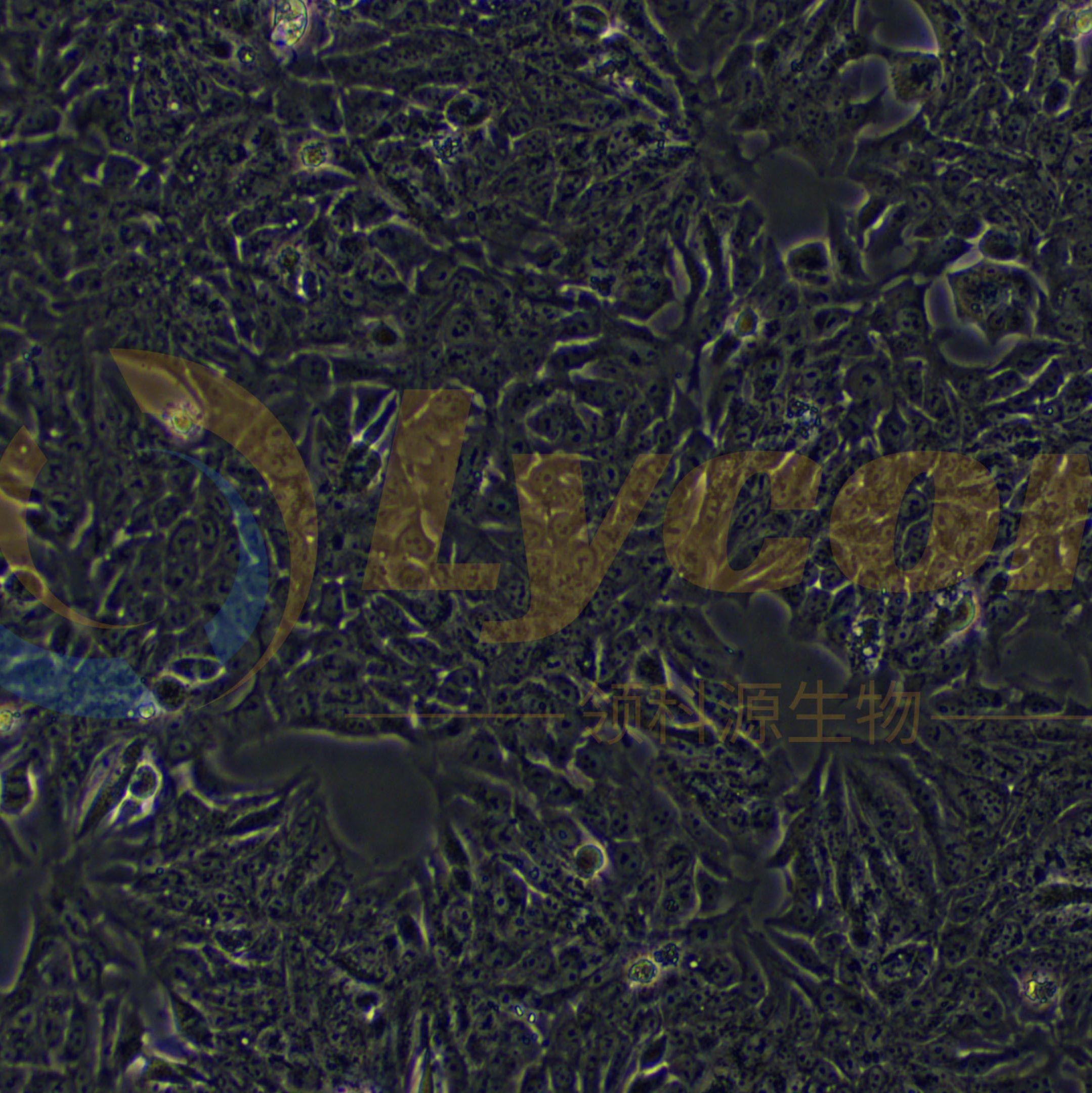 人结直肠腺癌上皮细胞;DLD-1(STR)