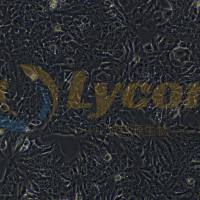 人结直肠腺癌上皮细胞;DLD-1(STR)