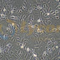 人乳腺癌细胞;MDA-MB-157(STR)