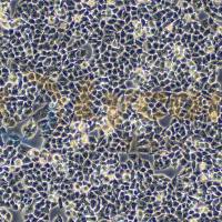 人卵巢癌细胞;A2780(STR)