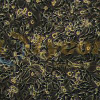 人乳腺癌细胞;MDA-MB-436(STR)