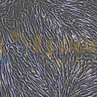 人胚肺成纤维细胞;MRC-5(STR)