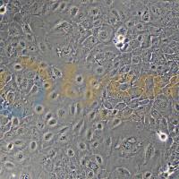 人类鳞状上皮舌癌细胞;SCC-9(STR)