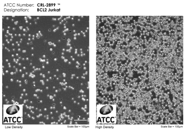 Jurkat、CTLL-2、MT-4、HuT-78，T淋巴细胞系培养合集来袭！
