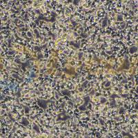 人神经母细胞瘤细胞；IMR-32(STR)