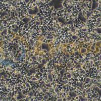 人胚肾细胞；293T(STR)