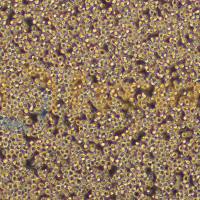 人原髓细胞白血病细胞;HL-60(STR)