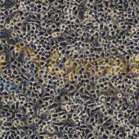 人子宫内膜癌细胞;Ishikawa(STR)