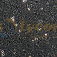 人晶体上皮细胞;SRA01/04