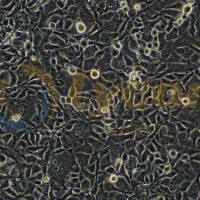 人少突胶质细胞；MO3.13(STR)