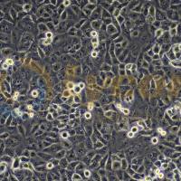 人胰腺癌细胞;PANC-1(STR)