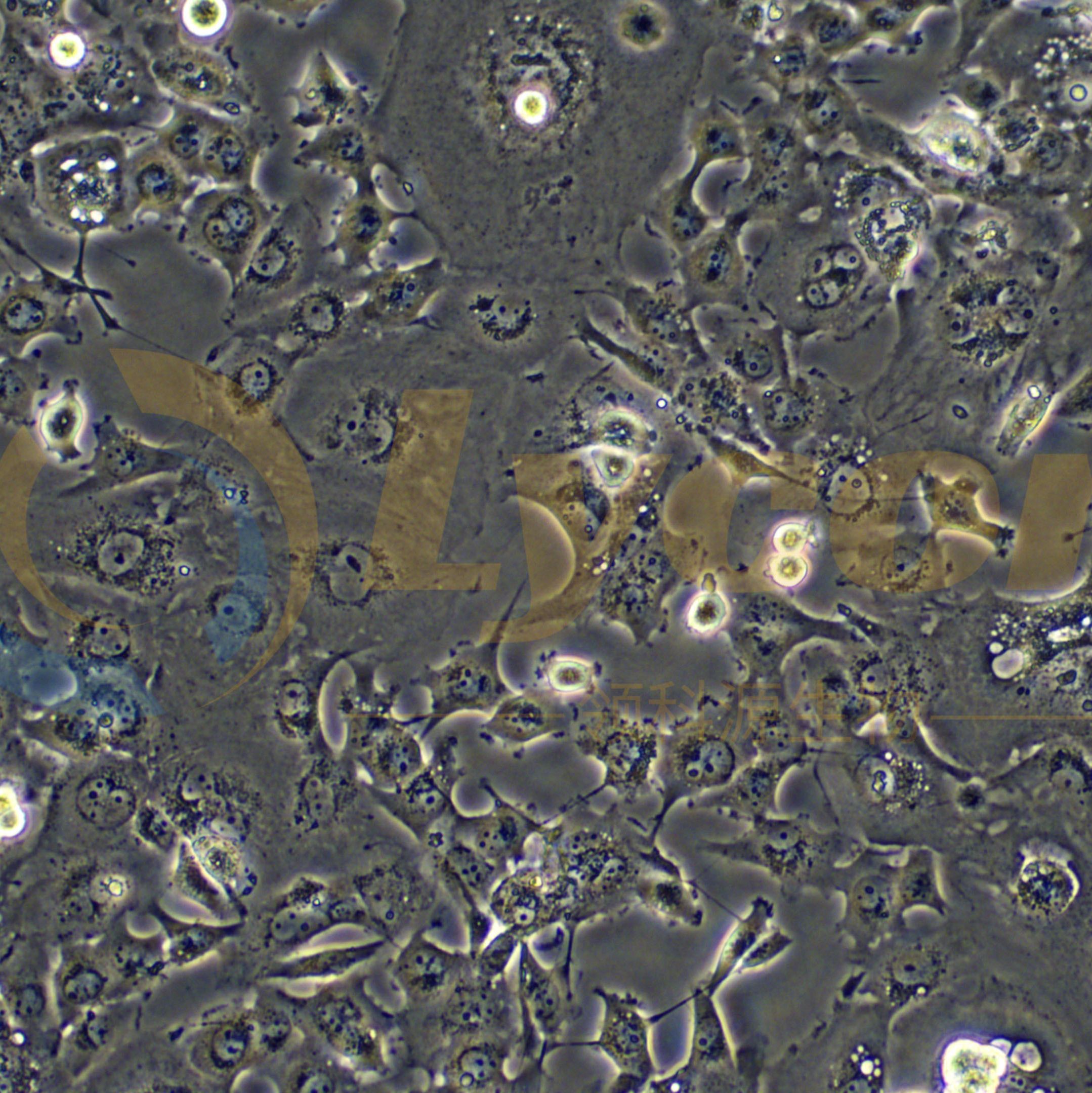 人胃癌细胞;Hs746T(STR)