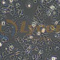 人胃癌细胞;Hs746T(STR)