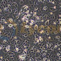 人子宫内膜癌细胞;HEC-1-A(STR)