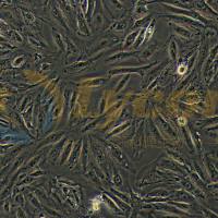 人肾癌细胞;A498(STR)