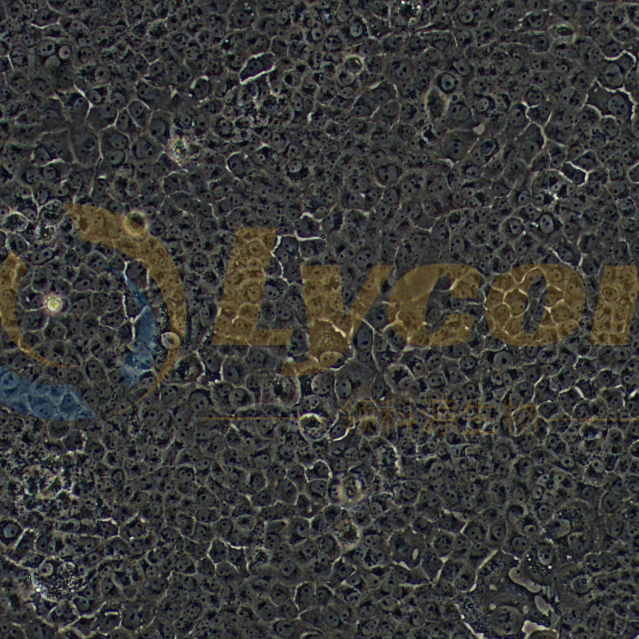 人舌鳞癌细胞;CAL 27(STR)