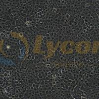 人舌鳞癌细胞;CAL 27(STR)