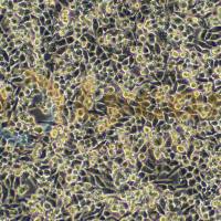 人胰腺导管癌细胞；MIA PaCa-2(STR)