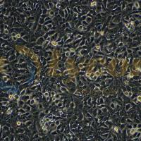 人乳腺腺癌细胞；MDA-MB-415(STR)