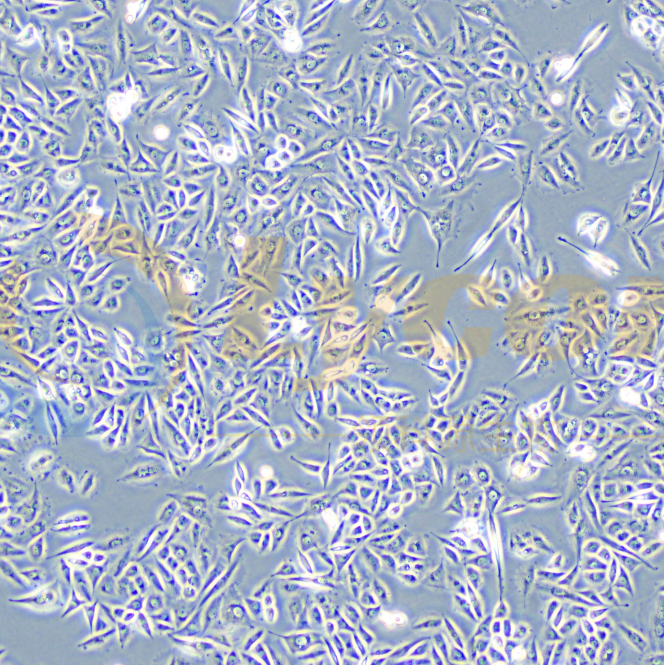 人子宫颈鳞状细胞癌细胞;SiHa(STR)