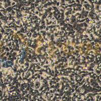 人结肠腺癌细胞；LS180(STR)