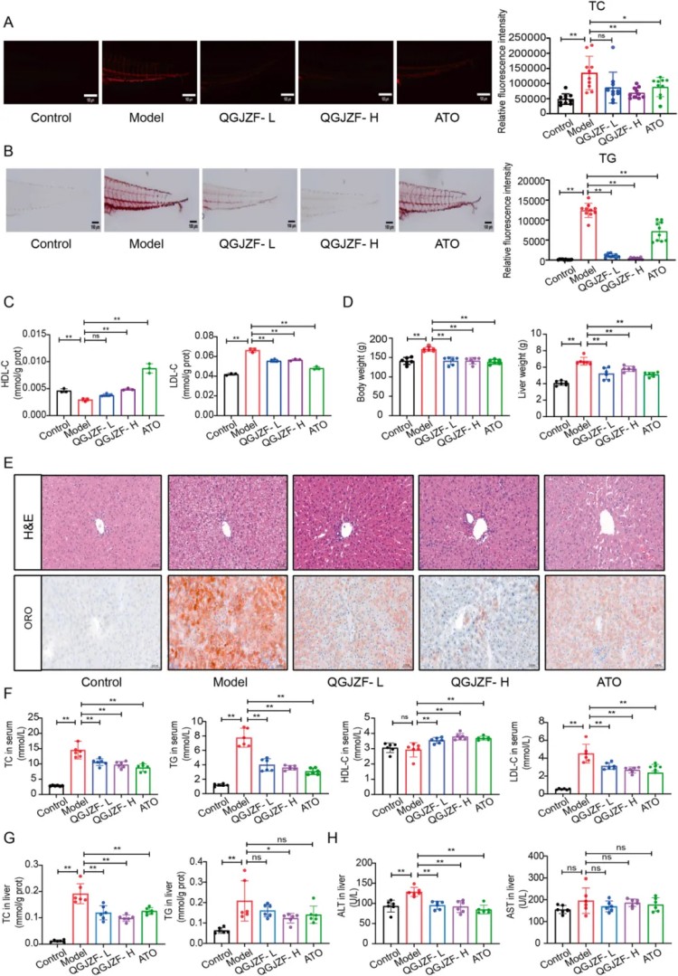 前沿探索：以循证体系探明芪桂降脂方治疗代谢相关脂肪肝的现代分子作用机制