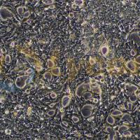 人前列腺癌细胞;Lncap(STR)