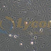 人胃癌细胞；MKN-7(STR)